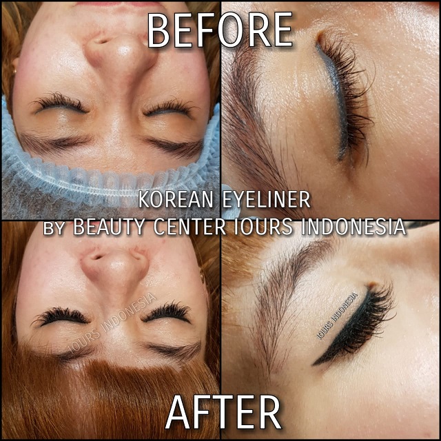 Beauty Treatment